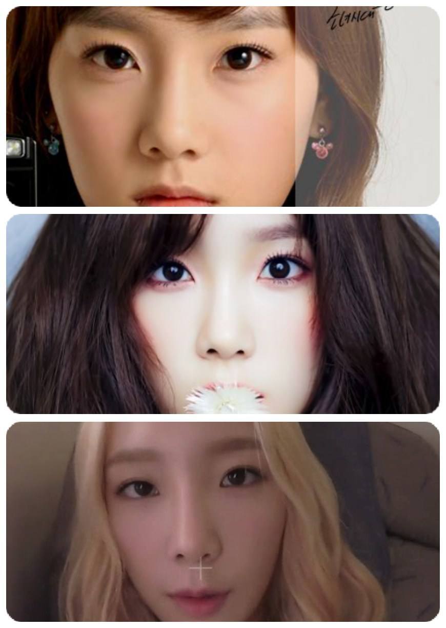 Irrefutable Evidence Of Girls Generation Taeyeons Eye Surgery